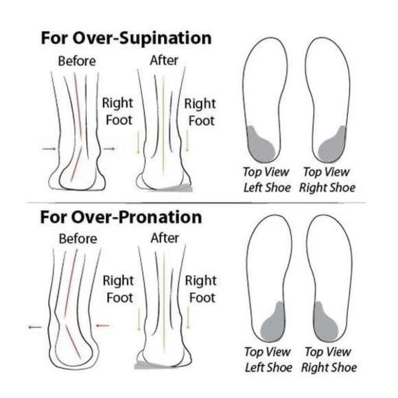 NWOB ORTHOTURE Arch Support & Breathable and Light & Non-Slip Shoes Black 14 - Picture 13 of 16